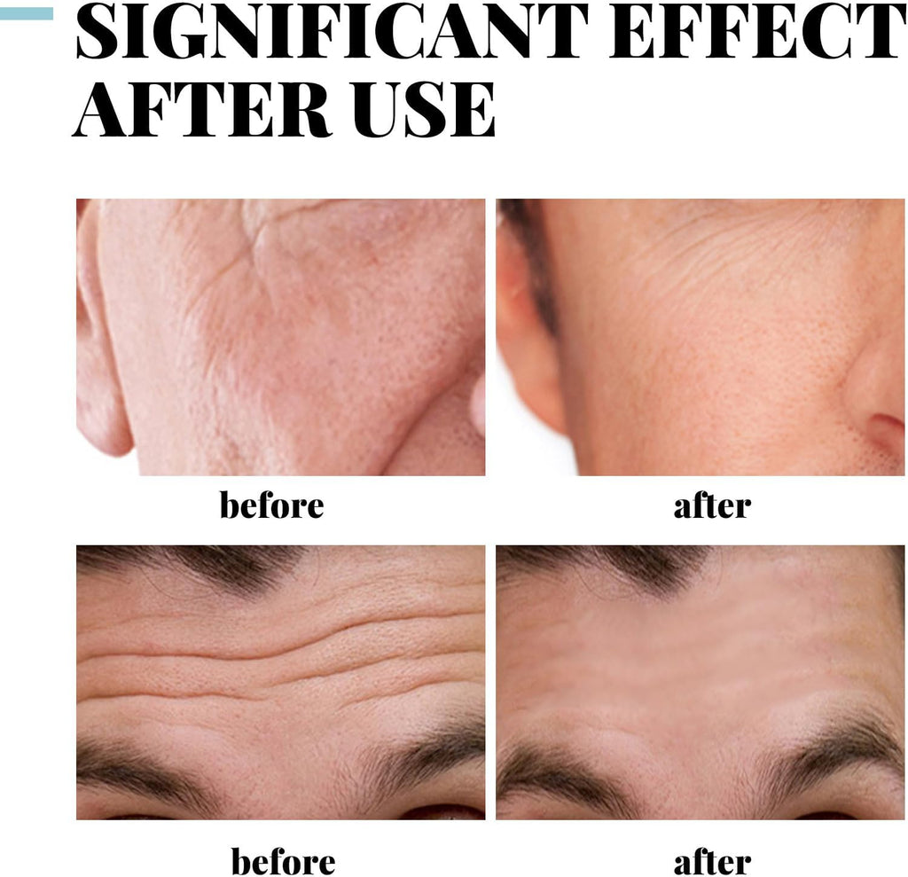 Skin Tightening Mens Crea,Anti-Aging Cream for Men,Facial Cream Moisturiser for Men,Collagen Mens Anti-Wrinkle Cream,Men Face Cream Reduce Fine Lines and Wrinkles,Skin Cream for Men